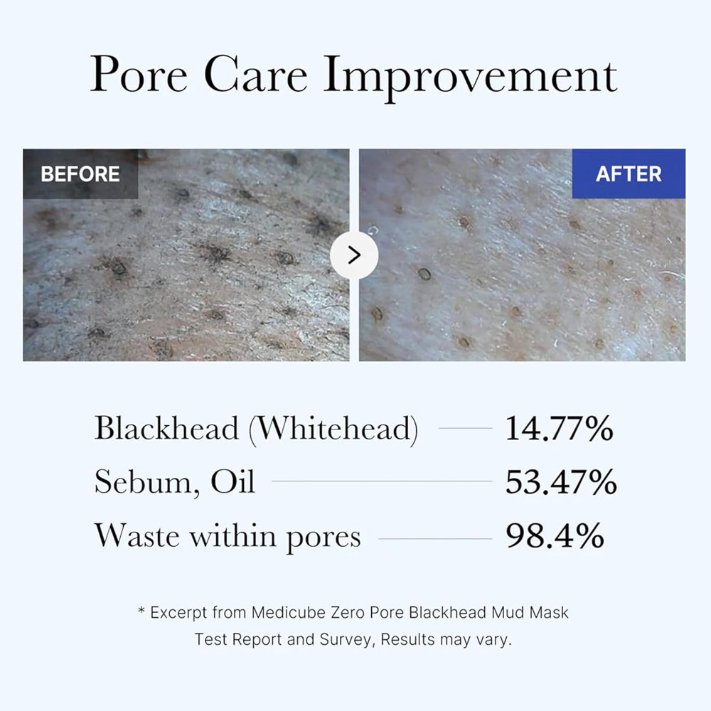 Medicube Zero Pore Blackhead Mud Mask 100g