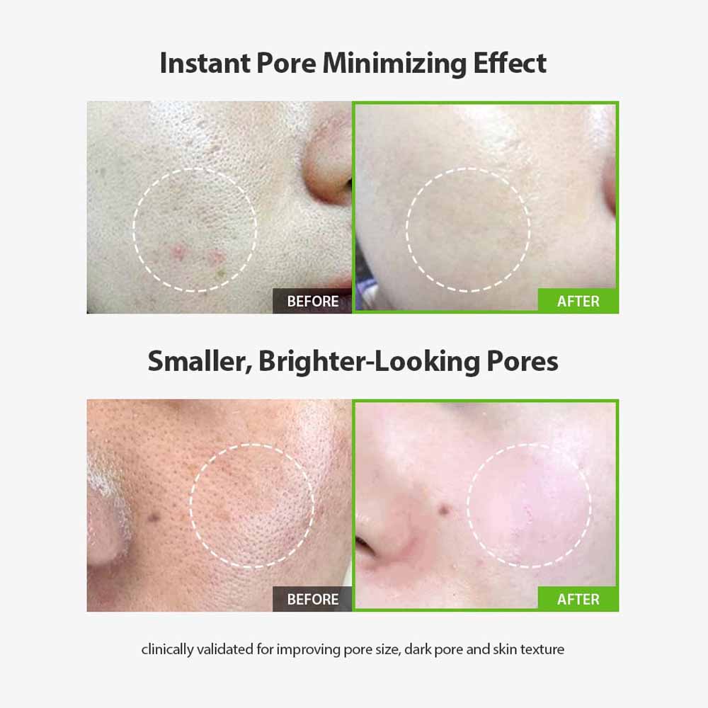Sungboon Editor Green Tomato Pore Lifting Ampoule 30ml