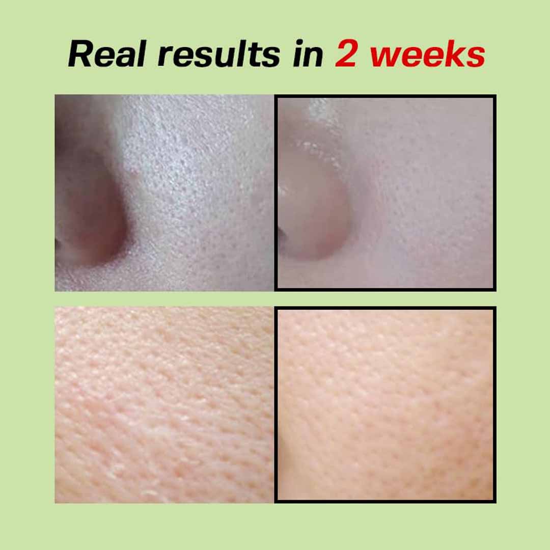 Sungboon Editor Green Tomato Pore Lifting Ampoule 30ml