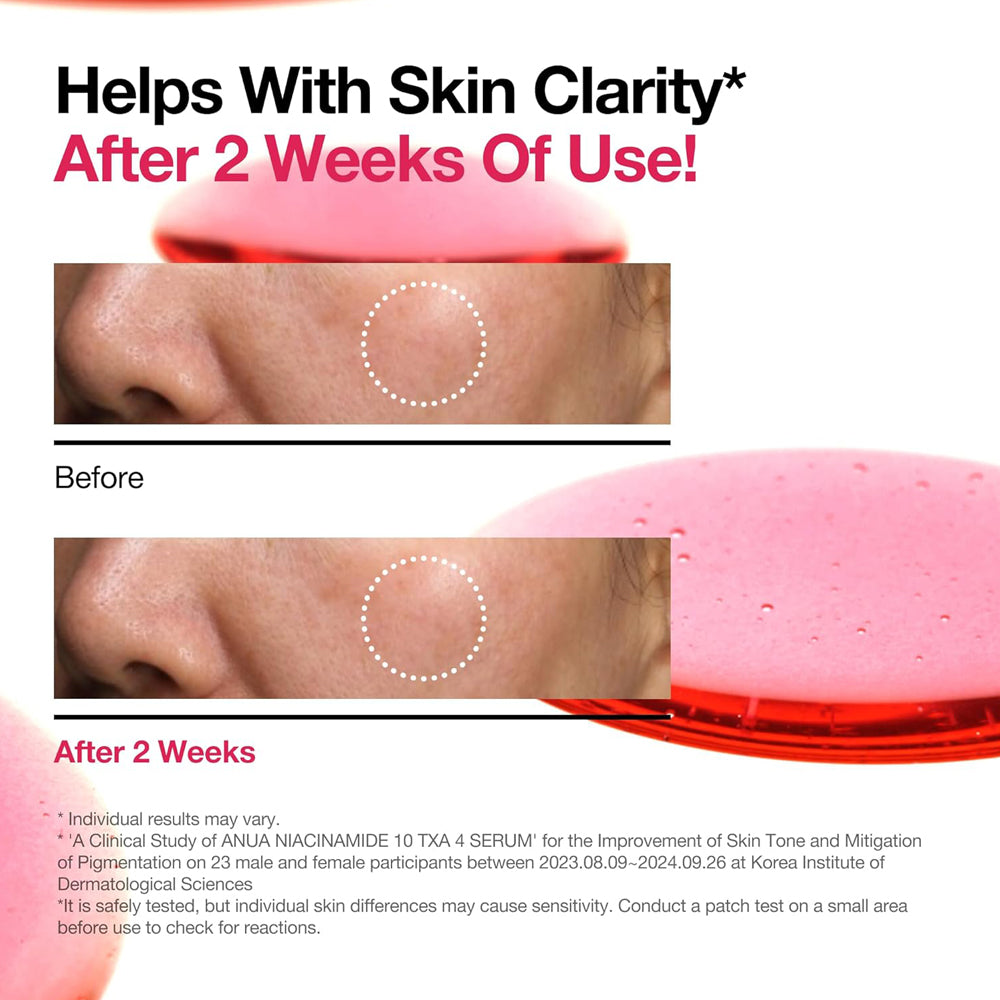 NIACINAMIDE10% + TXA 4% SERUM 30mL